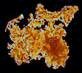 Microscopic View of Iron Bacteria Microscopic View of Iron Bacteria Removal